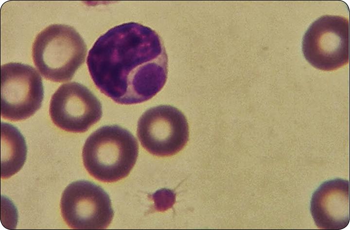 Diagnostyka erlichiozy