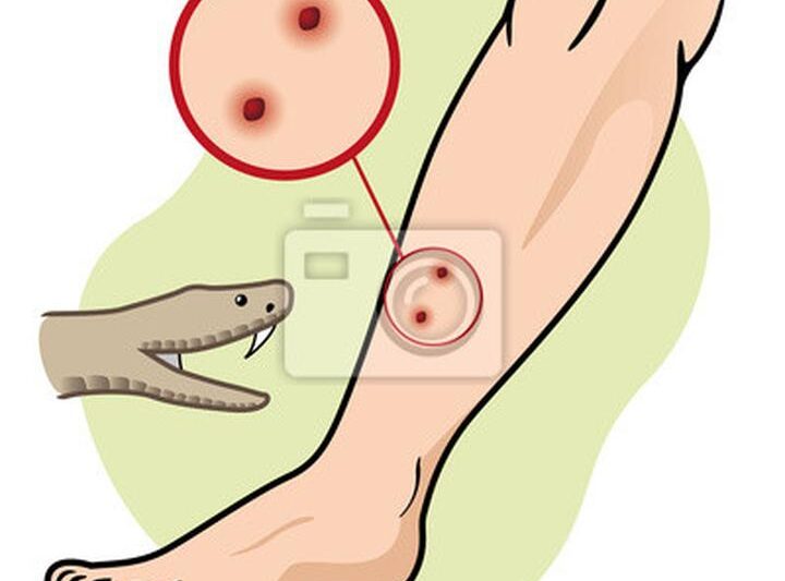 Jak postępować w przypadku ugryzienia zmii – pierwsza pomoc i profilaktyka